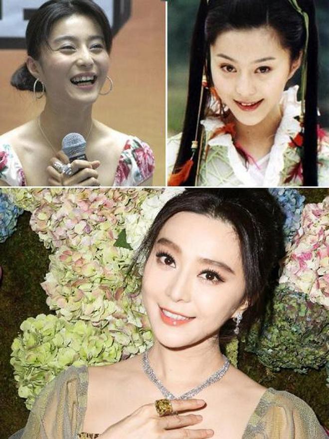 Sao Hoa Ngữ: người chăm chút chỉnh răng, người lại buông xuôi mặc kệ - Ảnh 8. Sao Hoa Ngữ: người chăm chút chỉnh răng, người lại buông xuôi mặc kệ - Ảnh 8.