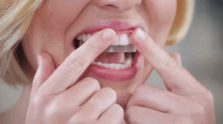 3 sản phẩm làm trắng răng rất tiện dụng bạn nên thử ngay tại nhà - Ảnh 4.