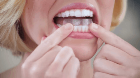 3 sản phẩm làm trắng răng rất tiện dụng bạn nên thử ngay tại nhà - Ảnh 5.