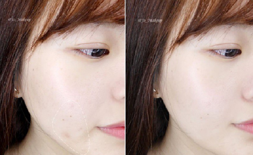 Nghe đồn thổi đ&atilde; nhiều về loại dầu chống rạn da - Bio Oil , nhưng bạn đ&atilde; biết phải sử dụng sao cho đ&uacute;ng - Ảnh 9.