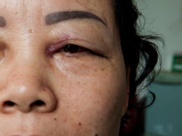 Hà Nội: Bảo vệ chung cư đánh nhân viên dọn vệ sinh đến tím mắt - Ảnh 2.