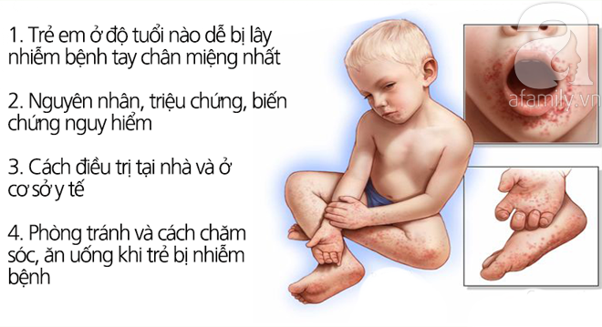 Tổng hợp cách chữa bệnh tay chân miệng cho trẻ hiệu quả theo hướng dẫn Bộ Y Tế - Ảnh 1.