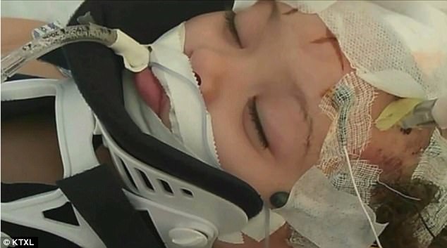 Bé gái 2 tuổi tổn thương não vì bị bảo mẫu là một cậu thiếu niên 16 tuổi trừng phạt - Ảnh 1.