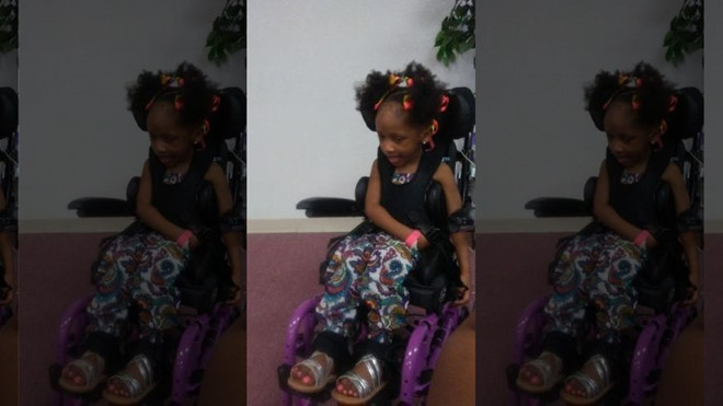Sai lầm chết người khiến cô bé 4 tuổi phải ngồi xe lăn cả đời sau khi nhổ răng - Ảnh 1.