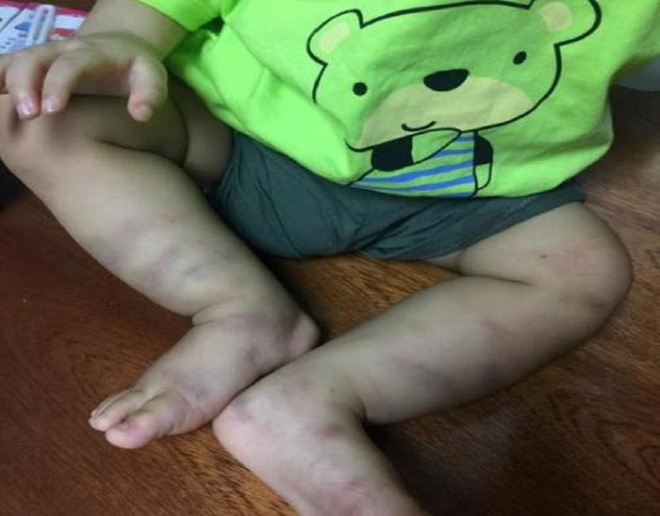 Vụ bé trai 1 tuổi bị bạo hành: Người mẹ có nguyện vọng nếu bị thi hành án không muốn đưa con vào trại - Ảnh 2. Vụ bé trai 1 tuổi bị bạo hành: Người mẹ có nguyện vọng nếu bị thi hành án không muốn đưa con vào trại - Ảnh 2.