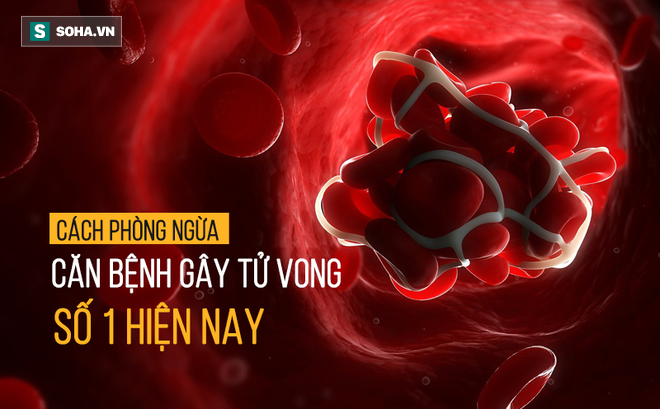 Căn bệnh trăm nghìn người chết mỗi năm ở VN: Không phải ung thư, Trung Quốc đang cảnh báo - Ảnh 1.