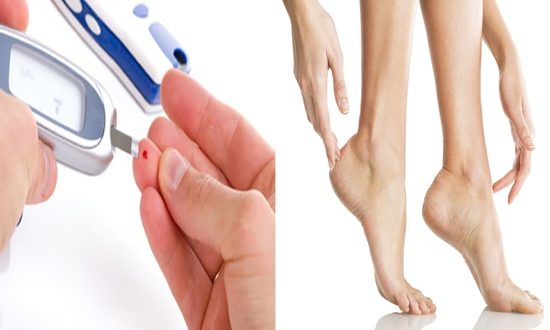 Những tổn thương trên da liên quan đến bệnh tiểu đường: Nhìn là nhận ra ngay - Ảnh 11. Những tổn thương trên da liên quan đến bệnh tiểu đường: Nhìn là nhận ra ngay - Ảnh 11.