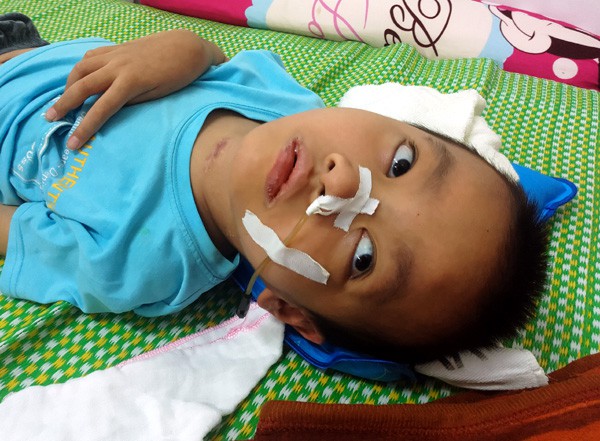 Sau trận sốt cao, bé trai khỏe mạnh thành người tàn phế, bố mẹ khốn khó vì gia cảnh ngặt nghèo - Ảnh 3. Sau trận sốt cao, bé trai khỏe mạnh thành người tàn phế, bố mẹ khốn khó vì gia cảnh ngặt nghèo - Ảnh 3.