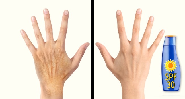 Làm ngay 4 việc này để da tay của bạn không lão hóa, khỏe đẹp không kém gì da mặt - Ảnh 6.