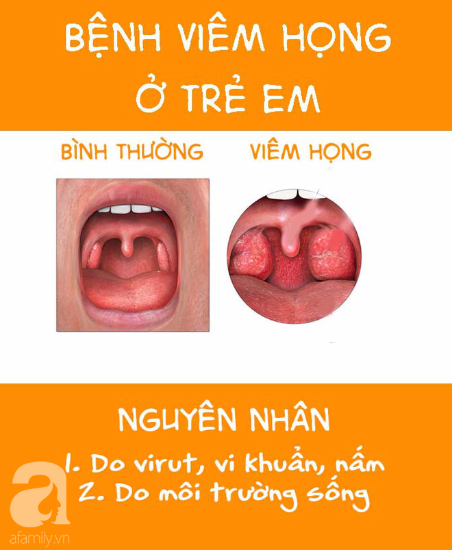 Con đau rát cổ, quấy khóc dữ dội vì bệnh viêm họng khiến mẹ phải ra tay với 21 phương thức chăm sóc mau khỏi - Ảnh 1.