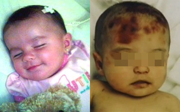 Vụ xâm hại chấn động nước Mỹ: Bé gái mới 5 tháng tuổi bị cha đẻ, cậu ruột lạm dụng, bạo hành, mẹ thờ ơ - Ảnh 2.