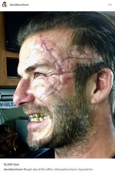 David Beckham dọa fan chết khiếp với khuôn mặt đầy sẹo và răng vàng ố - Ảnh 2.