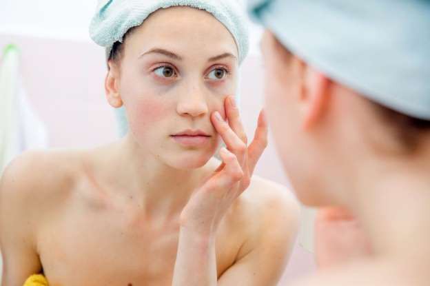 Những lưu ý khi đeo kính áp tròng, nếu biết rồi sẽ an toàn hơn cho bạn - Ảnh 2. Những lưu ý khi đeo kính áp tròng, nếu biết rồi sẽ an toàn hơn cho bạn - Ảnh 2.