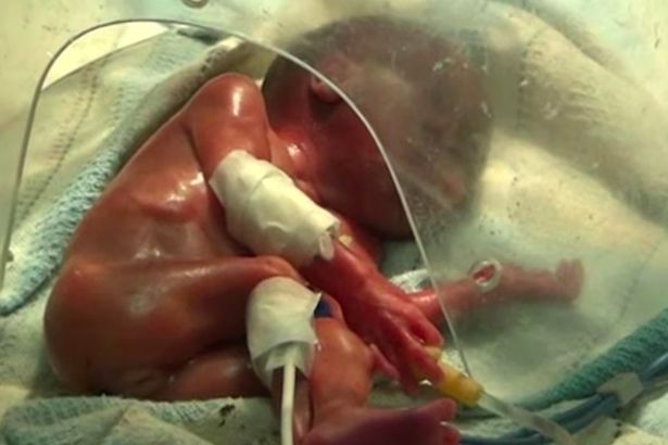 Em bé sinh non 24 tuần tuổi bất ngờ sống dậy vài giây trước khi gia đình hỏa táng - Ảnh 1.