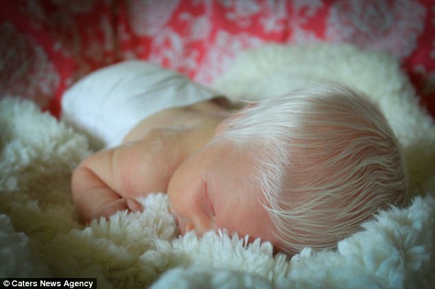 Em bé vừa chào đời đã có mái tóc bạc trắng như tuyết, làm náo loạn mạng xã hội - Ảnh 3.