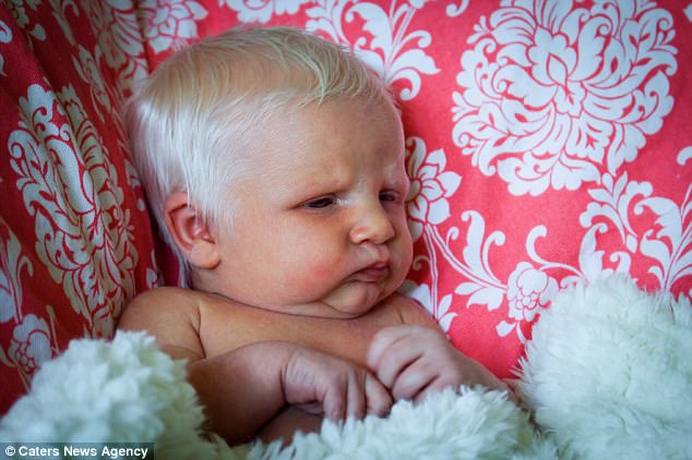Em bé vừa chào đời đã có mái tóc bạc trắng như tuyết, làm náo loạn mạng xã hội - Ảnh 5.