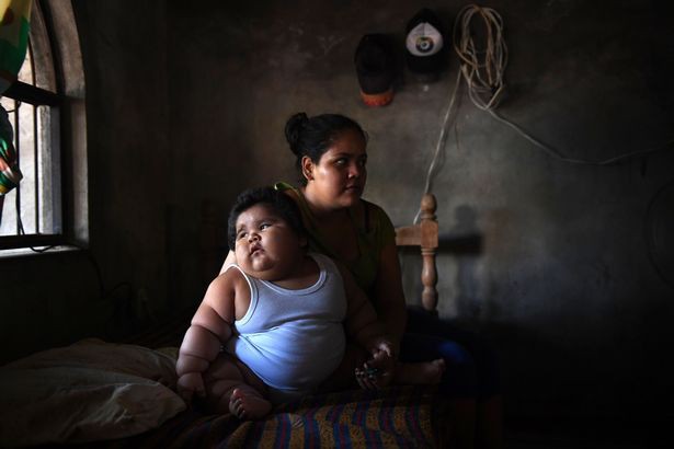 Con 10 tháng nặng 28kg, mẹ đinh ninh con hấp thụ sữa mẹ tốt mà không ngờ mắc bệnh đặc biệt - Ảnh 5.