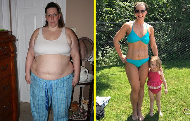 Từ chỗ không thể cài nổi giày vì quá béo, người phụ nữ này đã giảm gần 100kg mà không đến phòng tập - Ảnh 1.