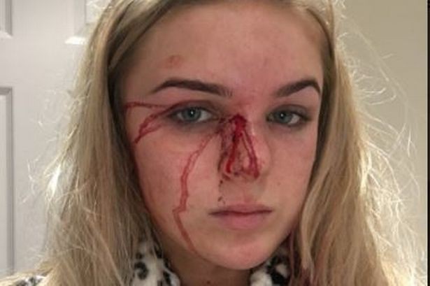Cô gái 19 tuổi cố gắng thoát thân sau khi bị bạn trai lột sạch quần áo và đánh đập tàn nhẫn - Ảnh 4.