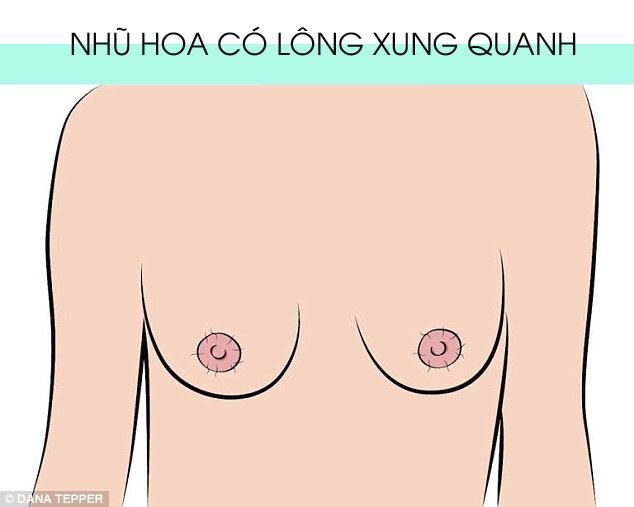 Hình dạng nhũ hoa cũng cảnh báo tình trạng sức khỏe của bạn - Ảnh 7.