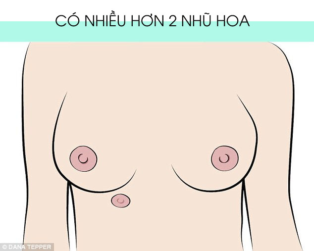 Hình dạng nhũ hoa cũng cảnh báo tình trạng sức khỏe của bạn - Ảnh 8.