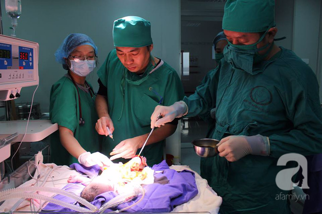 Quảng Ninh: Một bé gái sơ sinh lộ nguyên nội tạng ngoài bụng được cứu sống thần kỳ - Ảnh 2.
