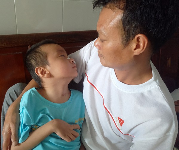 Sau trận sốt cao, bé trai khỏe mạnh thành người tàn phế, bố mẹ khốn khó vì gia cảnh ngặt nghèo - Ảnh 7. Sau trận sốt cao, bé trai khỏe mạnh thành người tàn phế, bố mẹ khốn khó vì gia cảnh ngặt nghèo - Ảnh 7.