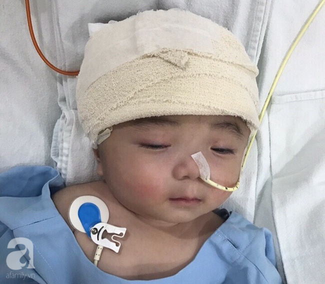 Một ngày sau cuộc tiểu phẫu, em bé não úng thuỷ Phạm Đức Lộc đã biết mở mắt, cử động tay chân - Ảnh 1.