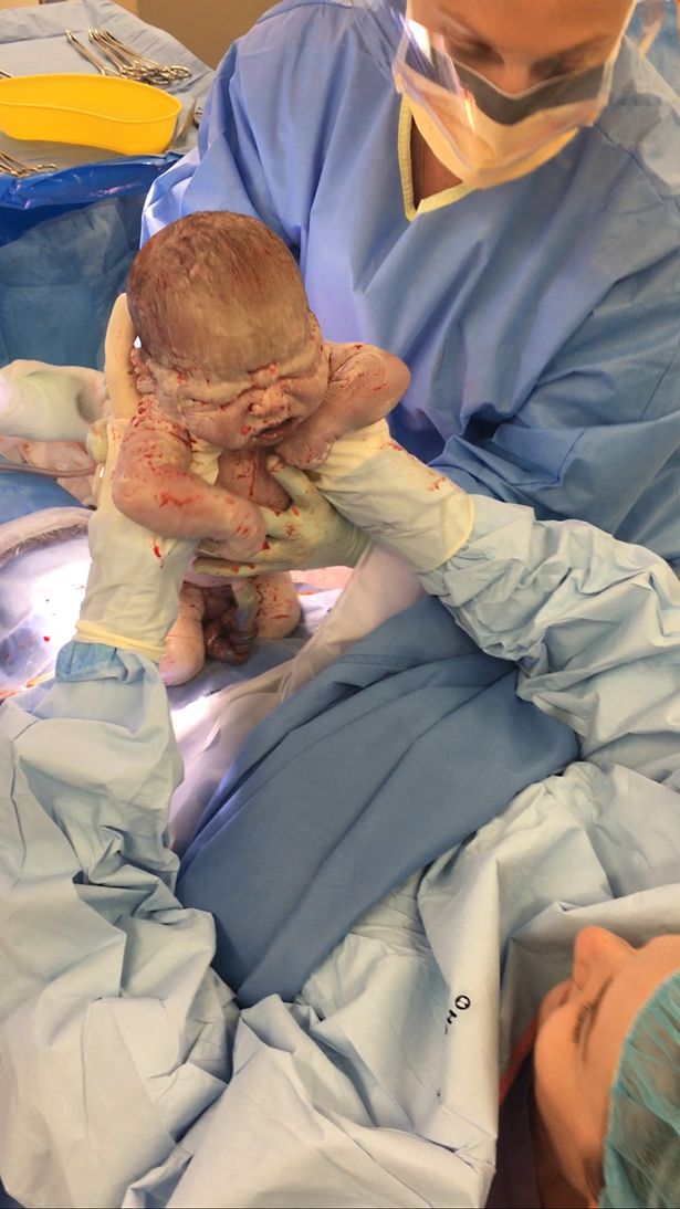 Khoảnh khắc ấn tượng: Bà mẹ sinh mổ tự đưa tay lấy con ra khỏi bụng - Ảnh 2.