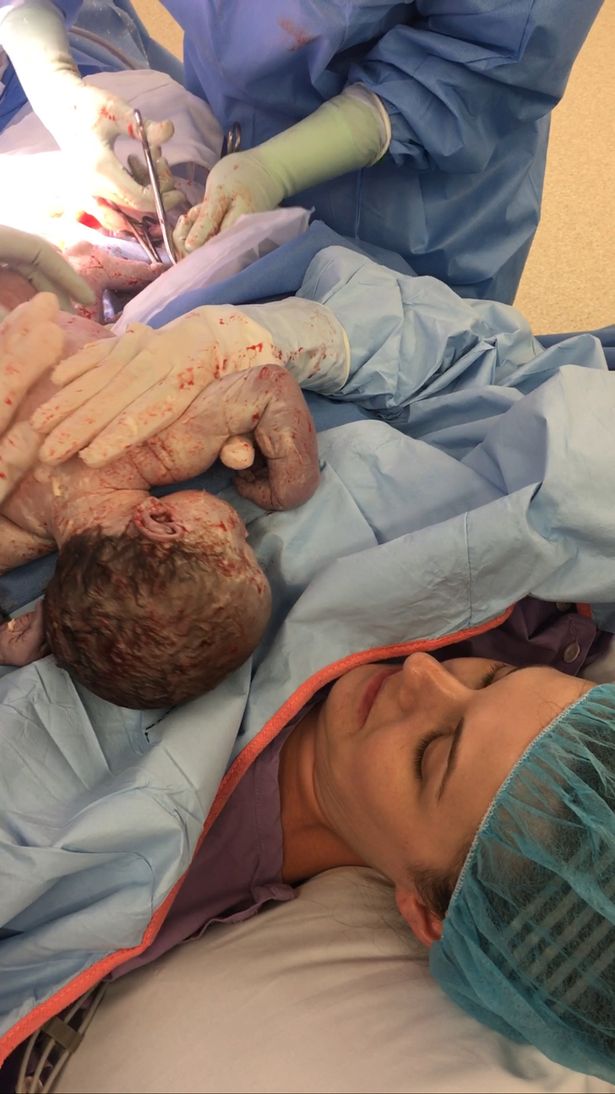 Khoảnh khắc ấn tượng: Bà mẹ sinh mổ tự đưa tay lấy con ra khỏi bụng - Ảnh 3.