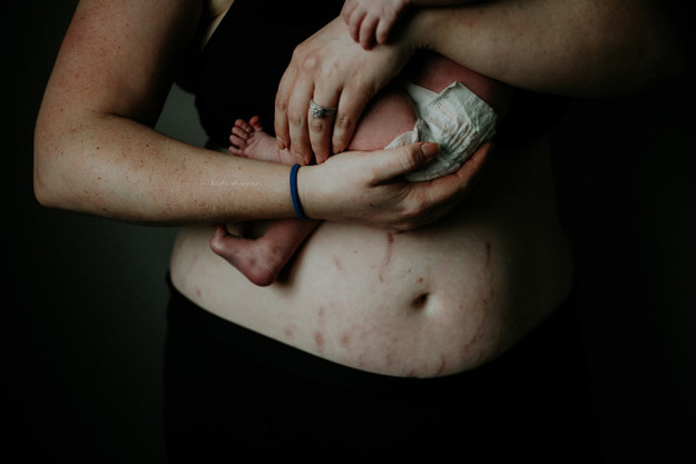 Bèo nhèo và chằng chịt vết rạn, đây mới là hình ảnh thật nhất về cơ thể người mẹ sau sinh - Ảnh 8.