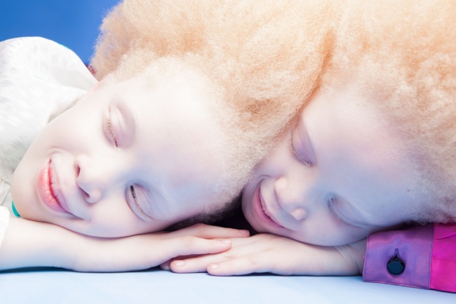 Vẻ đẹp của cặp sinh đôi bạch tạng hiếm có khó tìm nhất thế giới - Ảnh 1.