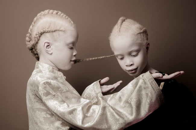 Vẻ đẹp của cặp sinh đôi bạch tạng hiếm có khó tìm nhất thế giới - Ảnh 2.
