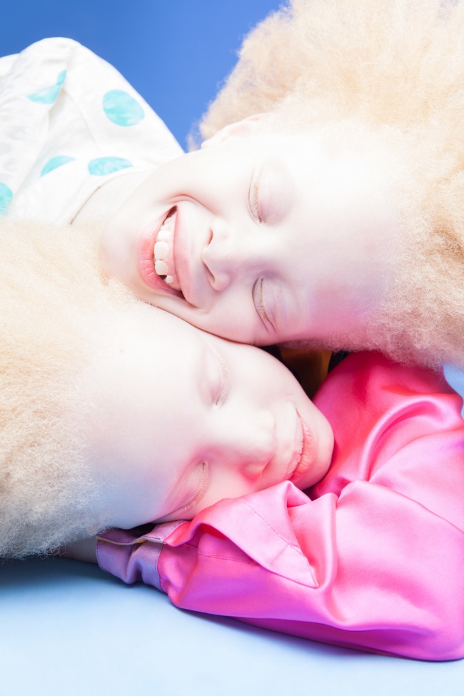 Vẻ đẹp của cặp sinh đôi bạch tạng hiếm có khó tìm nhất thế giới - Ảnh 5.