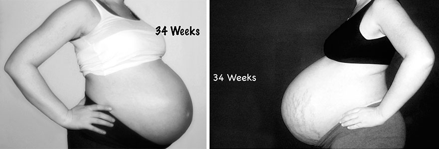 34 неделя беременности можно. Животы беременных двойней. 34 Неделя беременности двойней живот. Беременность двойней по неделям.
