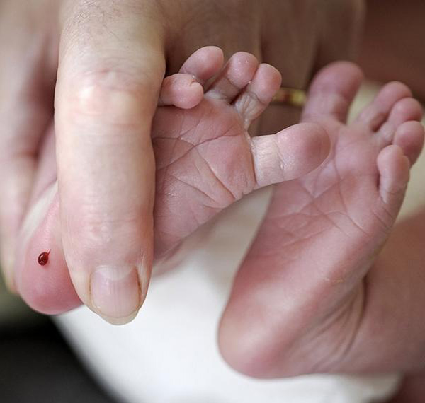 Đây là lý do bố mẹ nhất định phải lấy máu gót chân sau sinh cho con - Ảnh 1.