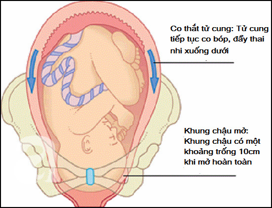 7 dấu hiệu rõ ràng cho thấy mẹ bầu đã chuyển dạ