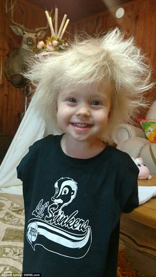 Lý giải khoa học đằng sau mái tóc kỳ lạ, trông như hoa bồ công anh của cô bé 2 tuổi - Ảnh 1.