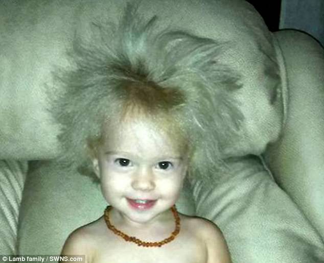 Lý giải khoa học đằng sau mái tóc kỳ lạ, trông như hoa bồ công anh của cô bé 2 tuổi - Ảnh 2.