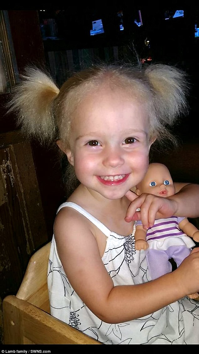 Lý giải khoa học đằng sau mái tóc kỳ lạ, trông như hoa bồ công anh của cô bé 2 tuổi - Ảnh 4.