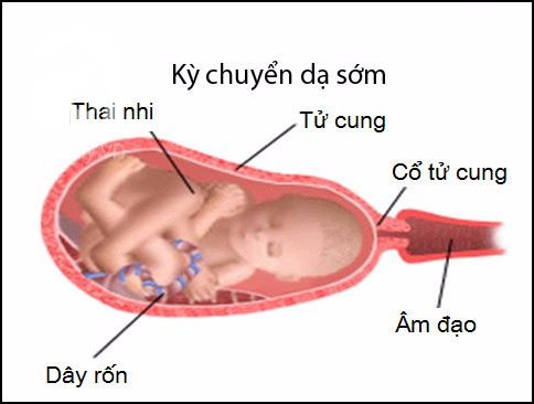 Tường tận ba giai đoạn của quá trình sinh nở tự nhiên mẹ bầu cần biết - Ảnh 3.