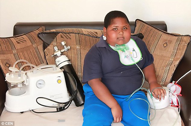 Mới 10 tuổi cậu bé này đã nặng gần 100kg, ăn cả giấy vệ sinh vì không thấy no - Ảnh 2.