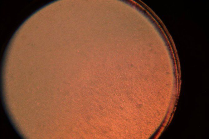 So s&aacute;nh sự kh&aacute;c biệt đ&aacute;ng kinh ngạc giữa sữa mẹ, sữa c&ocirc;ng thức v&agrave; sữa b&ograve; dưới k&iacute;nh hiển vi - Ảnh 4.