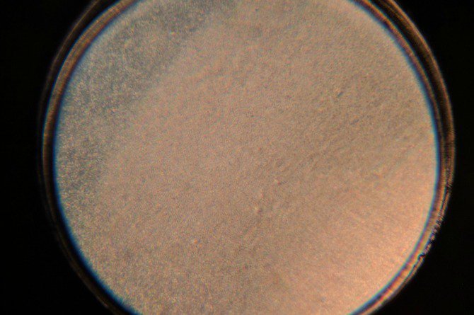 So s&aacute;nh sự kh&aacute;c biệt đ&aacute;ng kinh ngạc giữa sữa mẹ, sữa c&ocirc;ng thức v&agrave; sữa b&ograve; dưới k&iacute;nh hiển vi - Ảnh 5.