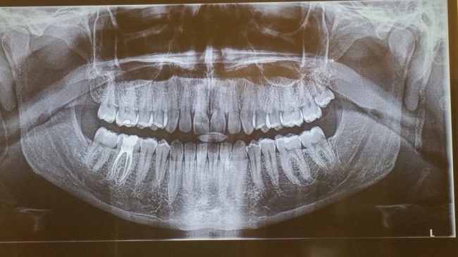 Chỉ một số ít người trên thế giới sở hữu đặc điểm lạ lùng này - Ảnh 1.