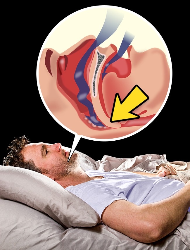 Đây là những hiện tượng kỳ lạ xảy ra khi bạn chìm vào giấc ngủ, ai cũng từng mắc mà không biết tại sao - Ảnh 7. Đây là những hiện tượng kỳ lạ xảy ra khi bạn chìm vào giấc ngủ, ai cũng từng mắc mà không biết tại sao - Ảnh 7.