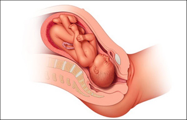 Bác sĩ tiết lộ sự thật về việc giãn nở cổ tử cung và cách kích thích để nhanh sinh nở - Ảnh 2.