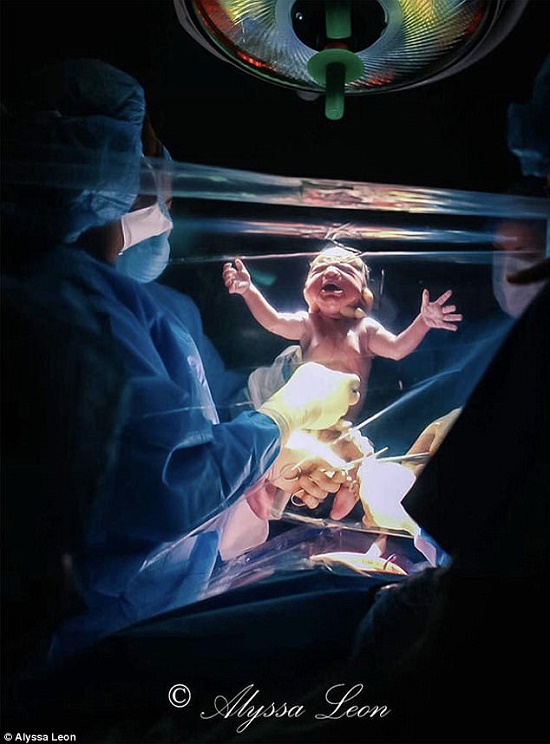 Màn chắn trong suốt: Điểm mới trong sinh mổ giúp mẹ tận mắt chứng kiến quá trình chào đời của con - Ảnh 2.