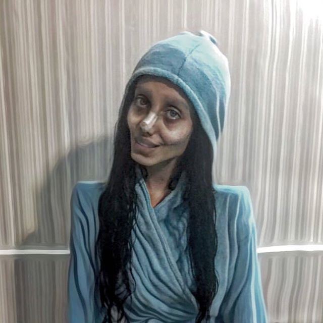 19 tuổi cô ấy đã phẫu thuật thẩm mỹ 50 lần để giống Angelina, 10 năm sau dung nhan hậu phẫu quả khiến người ta chết đứng - Ảnh 10.
