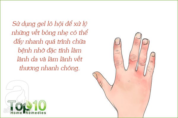 Đây là 7 công dụng của lô hội được các nhà nghiên cứu thừa nhận, từ bảo vệ da, tóc đến ngừa bệnh tiểu đường - Ảnh 8.